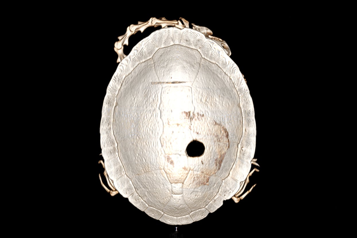CT scan